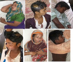 তজুমদ্দিনের চরে হামলা, নারী শিশুসহ ৬ জন আহত