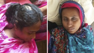 তজুমদ্দিনে কলা চুরির প্রতিবাদ করায় দুই নারীকে পিটিয়ে আহত