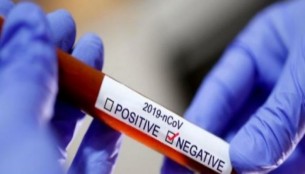 ভোলায় আরো ২৫ জনে নমুনা রির্পোট নেগেটিভ