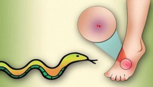 ভোলায় সাপের কামড়ে এক যুবকের মৃত্যু