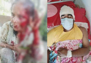 চরফ্যাসনে জমির বিরোধ নিয়ে বৃদ্ধার চোখ উপরে ফেলার চেষ্টা