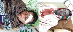 চরফ্যাশনে চেয়ারম্যানের ভাই ও ভাতিজা পা ভেঙ্গে দিলো দোকানীর!