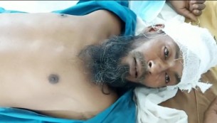 ভোলায় জমির বিরোধ মিমাংশায় সালিশে হামলা আহত ১০