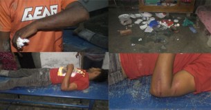 দৌলতখানে জমির বিরোধ নিয়ে  হামলা মারধর : আহত-৬