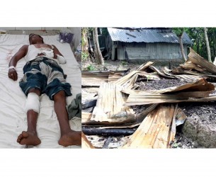 চরফ্যাশনে শ্বশুরের নির্দেশে  জামাইকে হত্যার চেষ্টা