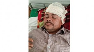 চরফ্যাশনে পাওনা টাকা চাওয়ায় হামলার অভিযোগ