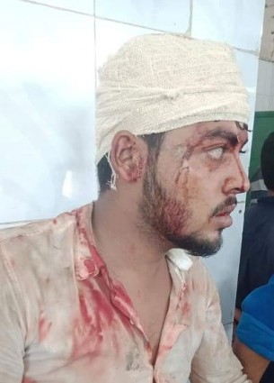 ভোলায় মাদক সেবনে বাঁধা দেয়ায়  হামলা কুপিয়ে জখম, আহত-৪