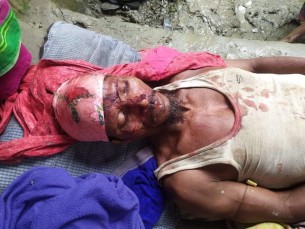 দৌলতখানে দোকানের জমি নিয়ে        সংঘর্ষ নারীসহ আহত-৫