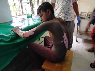 মনপুরায় জেলে ট্রলারে গ্যাসের চুলার আগুনে এক জেলে দগ্ধ