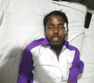 বোরহানউদ্দিনে তুচ্ছ ঘটনায় বোরক চালককে মারধর