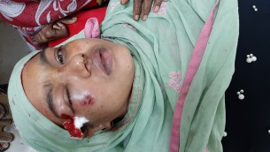 চরফ্যাশনে ঋণ নিতে রাজি না হওয়ায় গৃহবধূকে নির্যাতন