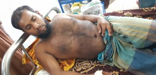 ভোলায় জমিসংক্রান্ত বিরোধ নিয়ে যুবককে কুপিয়ে জখম