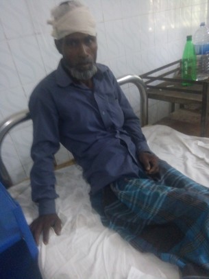 ভোলার পূর্ব ইলিশায় শালিস চলাকালে  চাচাকে পিটিয়ে জখম করলো ভাতিজা