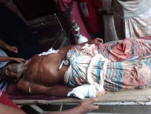 দৌলতখানে বৃদ্ধকে কুপিয়ে জখম