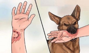 চরফ্যাসনে কুকুরের কামড়ে শিশুর মৃত্যু