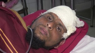 ভোলায় স্ত্রীকে পরকীয়া প্রেম থেকে  ফেরাতে গিয়ে হামলার শিকার স্বামী