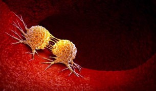 যে ব্যায়াম করলে ক্যানসার ছড়ায় না