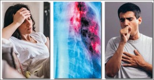 যক্ষ্মা কীভাবে ছড়ায় ও এর লক্ষণ কী কী?