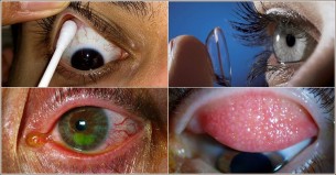 লেন্স পরার সময় যে ভুলে হয় চোখ নষ্ট