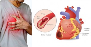 যে ৩ জিনিসের অতিরিক্ত ব্যবহারে ফাটল দেখা দেয় হৃদয়ে
