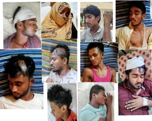 তজুমদ্দিনে দুই গ্রুপের সংঘর্ষে ১৫ জন আহত