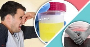 প্রস্রাবে দুর্গন্ধ কঠিন যে রোগের ইঙ্গিত দেয়