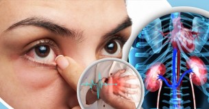 ডায়াবেটিস রোগীর কিডনি-হার্ট-চোখ নষ্ট হতেই যে লক্ষণ দেখা দেয়