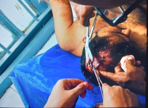 দৌলতখানে তুচ্ছ ঘটনা  নিয়ে যুবককে ইট দিয়ে পিটিয়ে জখম