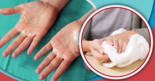 সব সময় হাত ঘামে, কঠিন রোগের লক্ষণ নয় তো?