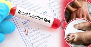 যে লক্ষণ দেখলেই কিডনি পরীক্ষা করা জরুরি