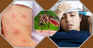 জ্বরসহ যেসব সমস্যা ডেঙ্গুর ইঙ্গিত দেয়