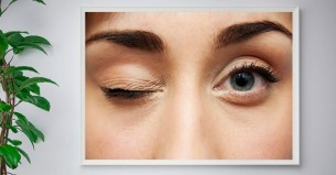 চোখ লাফানোও হতে পারে মারাত্মক অসুখ