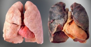 ফুসফুস পরিষ্কার রাখতে যা খাবেন