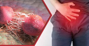 প্রোস্টেটের কোন সমস্যায় সতর্ক হবেন পুরুষরা?