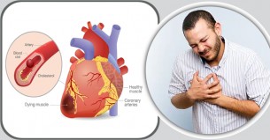 হঠাৎ হতে পারে কার্ডিয়াক অ্যারেস্ট, জেনে রাখুন লক্ষণ