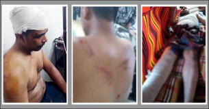 সমাবেশে ত্রিমুখী সংঘর্ষ: বেশ কয়েকজন সাংবাদিক আহত