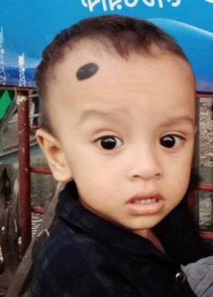 লালমোহনে কিডনি রোগে আক্রান্ত  এতিম শিশুকে বাচাঁতে আকুতি