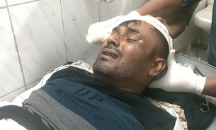 লালমোহনে আওয়ামী লীগ নেতাকে কুপিয়ে জখম