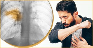 একটানা কাশি হচ্ছে, সাধারণ ঠান্ডা নাকি অন্য কোনো কারণ?