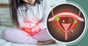 টয়লেট ব্যবহারের যে ভুলে নারীদের প্রস্রাবে ইনফেকশন হয়