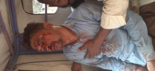 ভোলায় ফিল্মি স্টাইলে অপহরণ হত্যার চেষ্টার অভিযোগ