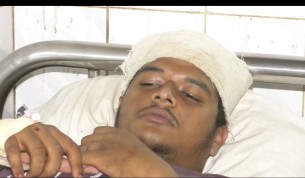 ভোলায় কিশোর গ্যাং এর হামলায় এইচএসসি পরীক্ষার্থীকে গুরুতর আহত