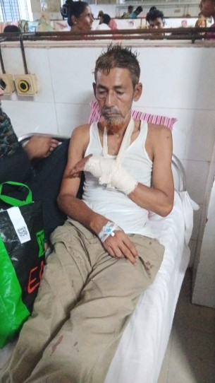 ভোলায় বিএনপির দুই গ্রুপের সংঘর্ষ  ওয়ার্ড সভাপতির হাতের কব্জি কর্তন