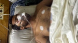 ভেঙেছে চোয়ালের হাড় মস্তিষ্কে রক্তক্ষরণ, আইসিইউতে নুর
