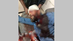 এবার এনসিপি নেতার মাথায় গুলি, অবস্থা আশঙ্কাজনক