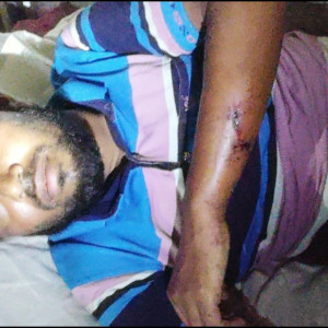 তজুমদ্দিনে মহিষের বাছুরের ঘাস খাওয়াকে কেন্দ্র করে মারামারি