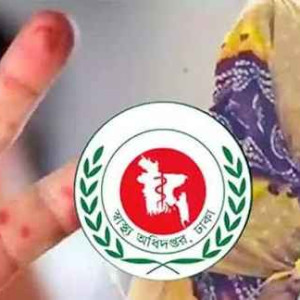 হাম উপসর্গে আরও ৮ জনের মৃত্যু